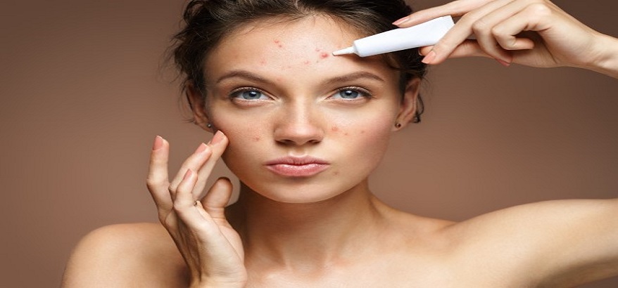 Tips Memilih Skincare Yang Ampuh Untuk  Menghilangkan Jerawat
